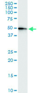 Anti-CENPJ Polyclonal Antibody Pair