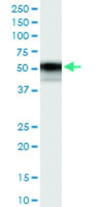 Anti-TNFRSF11B Polyclonal Antibody Pair