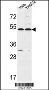 Anti-FERMT1 Rabbit Polyclonal Antibody (AP (Alkaline Phosphatase))