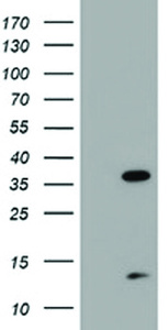 Anti-PDLIM2 Mouse Monoclonal Antibody [clone: OTI3B5]