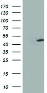 Anti-MTFMT Mouse Monoclonal Antibody [clone: OTI1C1]