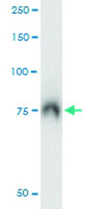 Anti-ABCF2 Mouse Monoclonal Antibody
