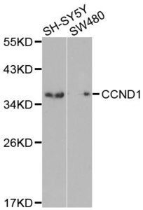 Western blot analysis of extracts of HeLa cell line using CCND1 antibody