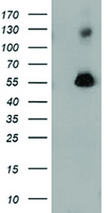 Anti-SQSTM1 Mouse Monoclonal Antibody [clone: OTI4E2]