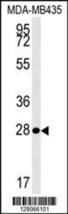 Anti-MRM1 Rabbit Polyclonal Antibody