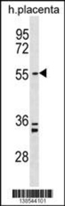 Anti-PAPD5 Rabbit Polyclonal Antibody (HRP (Horseradish Peroxidase))