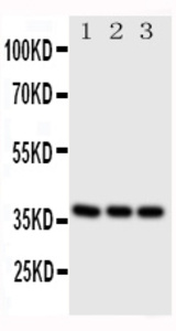 Anti-CD1a Rabbit Polyclonal Antibody