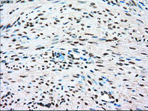 Anti-TYRO3 Mouse Monoclonal Antibody [clone: OTI4C8]