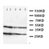 Anti-GPR2/CCR10 Rabbit Polyclonal Antibody