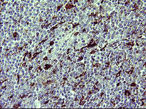 Anti-MMP13 Mouse Monoclonal Antibody [clone: OTI2A6]