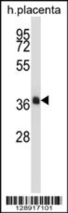 Anti-NKX2-4 Rabbit Polyclonal Antibody