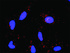 Anti-EGFR + EGF Antibody Pair