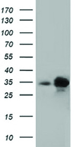 Anti-PECR Mouse Monoclonal Antibody [clone: OTI1C9]