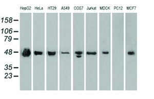 Anti-SSB Mouse Monoclonal Antibody [clone: OTI6G7]
