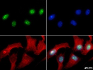 Anti-LRRK2 Rabbit Polyclonal Antibody (Biotin)