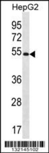 Anti-MGAT4C Rabbit Polyclonal Antibody (FITC (Fluorescein Isothiocyanate))