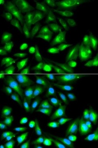 Immunofluorescense analysis of HeLa cell using RHOC antibody