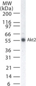 Anti-AKT2 Mouse Monoclonal Antibody [clone: 95C657.1.2]