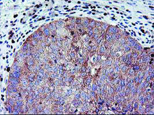 Anti-MEF2C Mouse Monoclonal Antibody [clone: OTI1B6]