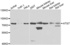 Western blot analysis of various cell lines lysates using ATG7 antibody