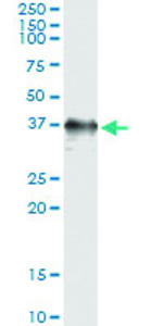 Anti-RAD51 Antibody Pair