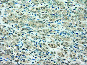 Anti-SSB Mouse Monoclonal Antibody [clone: OTI6G7]