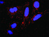 Anti-IKBKB + CTNNB1 Antibody Pair
