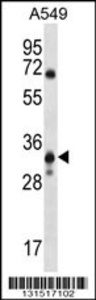 Anti-SLC25A53 Rabbit Polyclonal Antibody (HRP (Horseradish Peroxidase))