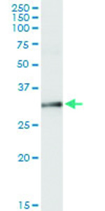 Anti-NAT1 Polyclonal Antibody Pair
