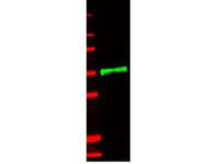 Anti-IL1R2 Rabbit Polyclonal Antibody