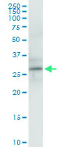 Anti-RGS5 Polyclonal Antibody Pair