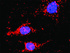 Anti-DVL1 + CTNNB1 Antibody Pair