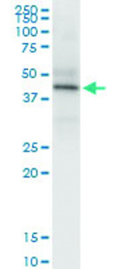 Anti-HLA C Polyclonal Antibody Pair