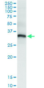 Anti-PYCR1 Polyclonal Antibody Pair