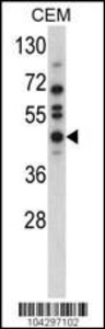 Anti-USP12 Rabbit Polyclonal Antibody (PE (Phycoerythrin))