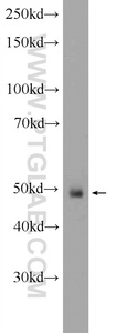 Anti-ANKRD33 Rabbit Polyclonal Antibody