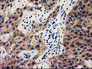 Anti-PYCRL Mouse Monoclonal Antibody [clone: OTI1B12]