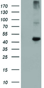 Anti-CPA1 Mouse Monoclonal Antibody [clone: OTI4F10]