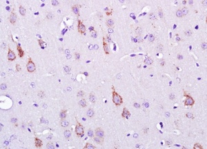 Immunohistochemical analysis of rat brain lysate with SEMA6D antibody.