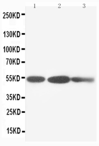 Anti-Cytokeratin 8 Rabbit Polyclonal Antibody