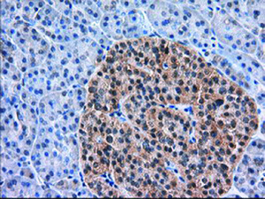 Anti-TACC3 Mouse Monoclonal Antibody [clone: OTI7B11]