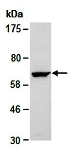 Western blot analysis of total cell extracts from mouse brain using NEFL antibody