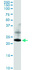 Anti-RAB22A Polyclonal Antibody Pair