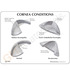 GPI Anatomicals® Cornea Eye Model