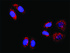 Anti-ACTN4 + CTNNB1 Antibody Pair