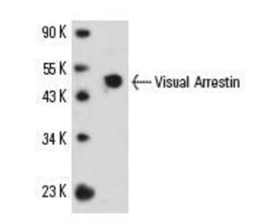 Anti-AGPAT6 Rabbit Polyclonal Antibody (Biotin)