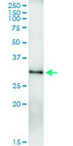 Anti-RAB23 Polyclonal Antibody Pair