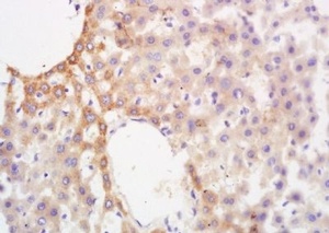 Immunohistochemical analysis of formalin-fixed paraffin embedded rat liver tissue using GCKR antibody (dilution at 1:200)