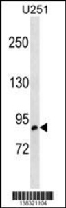 Anti-OSBPL10 Rabbit Polyclonal Antibody (HRP (Horseradish Peroxidase))