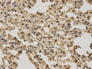 IHC-P image of mouse lung tissue using BRCA1 antibody (primary antibody dilution at 1:100)